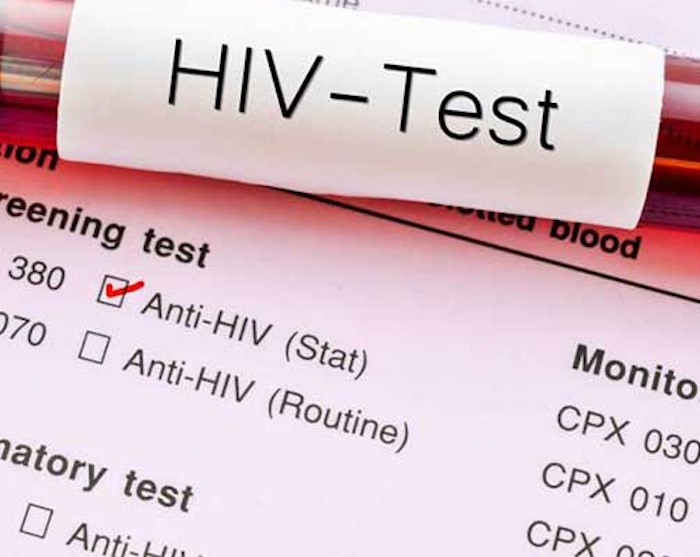 Nữ nghi&ecirc;n cứu sinh tiến sĩ 27 tuổi ph&aacute;t hiện nhiễm HIV, c&aacute;ch m&agrave; c&ocirc; bị l&acirc;y nhiễm khiến nhiều người "lạnh sống lưng" - Ảnh 1.