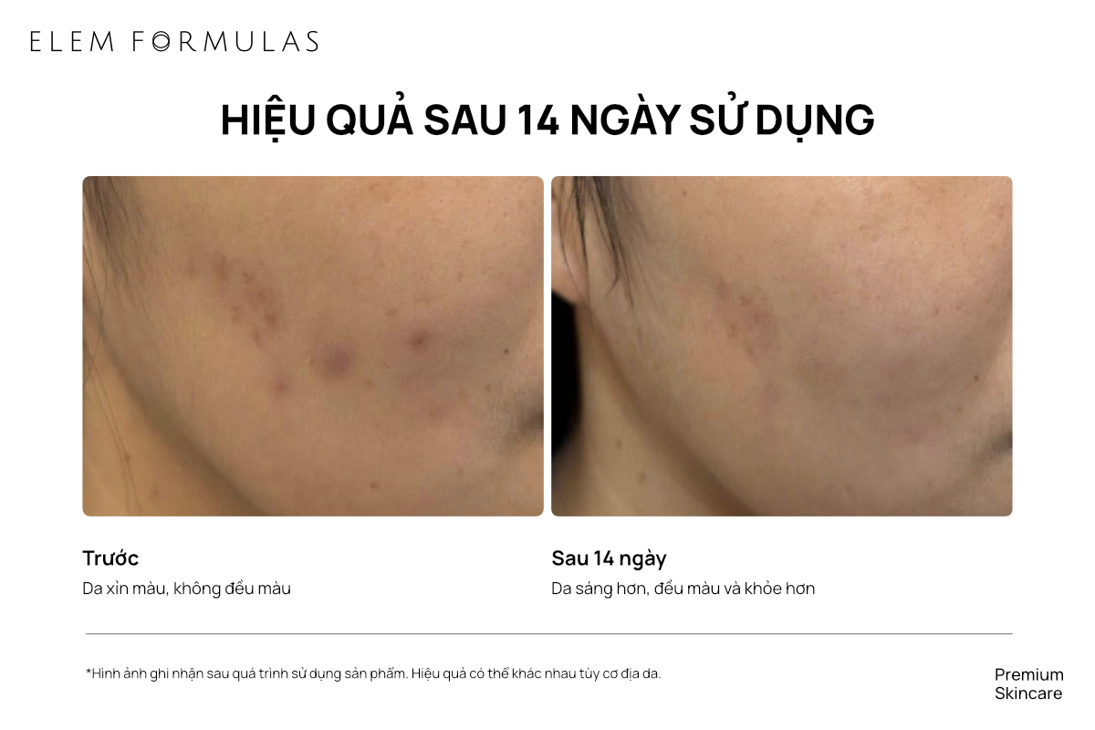 ELEM FORMULAS: Serum Autophagy và hành trình tái lập nền da khỏe - Ảnh 5.