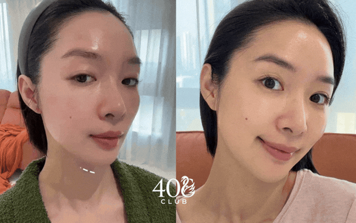 Người phụ nữ 39 tuổi tiết lộ 4 khoản đầu tư chống l&atilde;o h&oacute;a đ&aacute;ng gi&aacute; hơn việc mua th&ecirc;m mỹ phẩm- Ảnh 1.