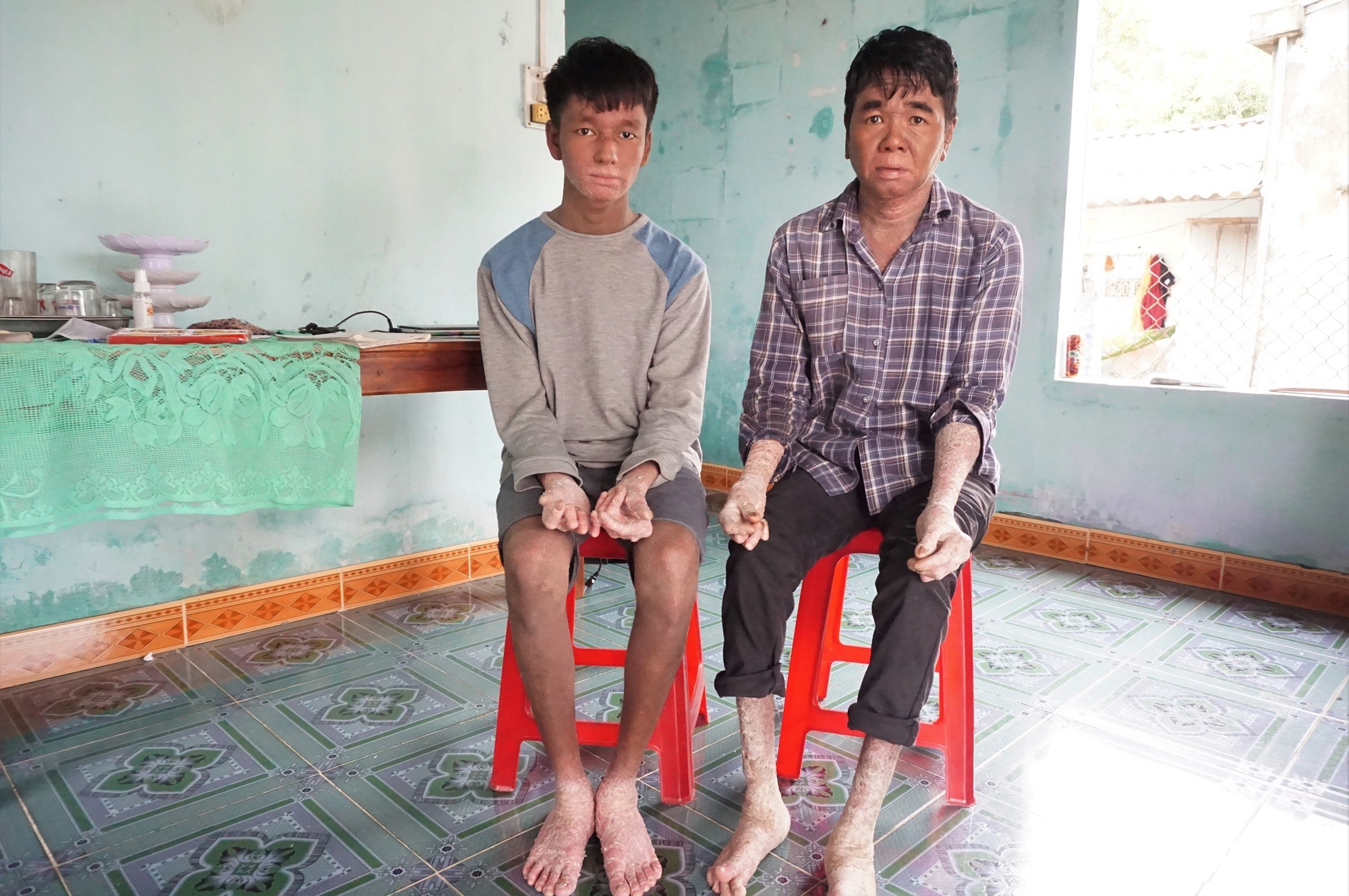 Cậu bé "người rắn" từng bị bạn bè xa lánh, 12 tuổi mới được vào lớp 1, giờ đã thành tân sinh viên- Ảnh 1.