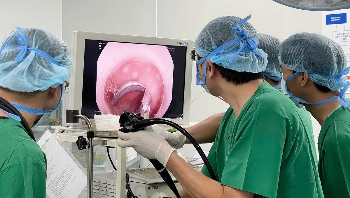 B&eacute; 3 tuổi đau bụng, b&aacute;c sĩ ph&aacute;t hiện &ldquo;vật lạ&rdquo; mắc trong t&aacute; tr&agrave;ng - Ảnh 1.