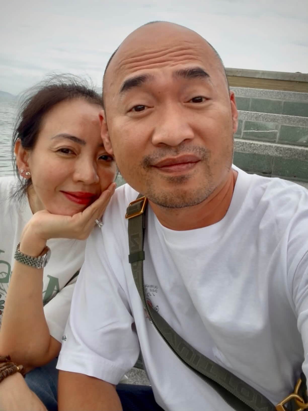Thu Trang bị thương nghi&ecirc;m trọng phải kh&acirc;u 20 mũi ở mặt, Tiến Luật: "D&ugrave; thế n&agrave;o em vẫn đẹp"- Ảnh 1.