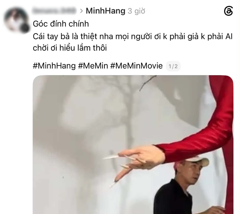 Ng&oacute;n tay biến dạng của Minh Hằng- Ảnh 6.
