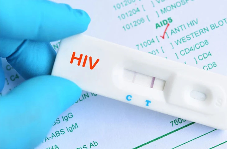 C&ocirc; g&aacute;i 22 tuổi ph&aacute;t hiện nhiễm HIV khi kh&aacute;m tiền h&ocirc;n nh&acirc;n, c&aacute;ch c&ocirc; bị l&acirc;y bệnh khiến ai nấy giật m&igrave;nh- Ảnh 1.