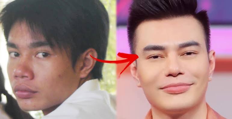 Người duy nhất khiến Trấn Th&agrave;nh phải n&iacute;n nhịn: Trộm v&agrave;ng sửa mũi để đổi vận, lập kỷ lục cả Vbiz kh&ocirc;ng ai muốn ph&aacute;- Ảnh 5.