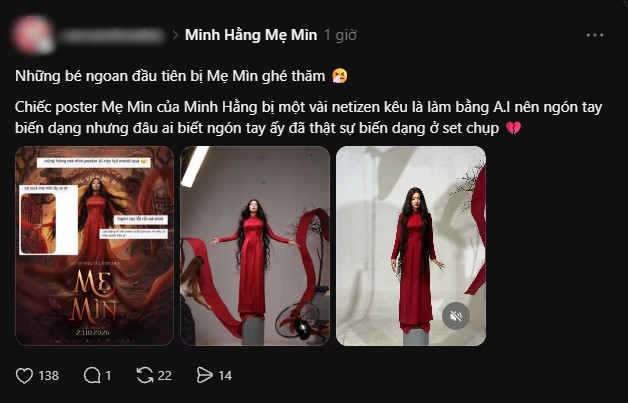 Ng&oacute;n tay biến dạng của Minh Hằng- Ảnh 3.