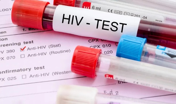 Người phụ nữ 27 tuổi ph&aacute;t hiện nhiễm HIV khi kh&aacute;m thai, c&aacute;ch c&ocirc; bị l&acirc;y nhiễm quen đến "lạnh sống lưng" - Ảnh 3.