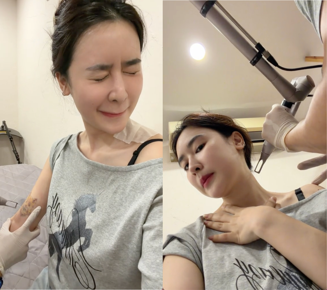 Quy&ecirc;n Qui - T&oacute;c Ti&ecirc;n cắn răng xo&aacute; xăm: C&ugrave;ng địa chỉ, chung cả l&yacute; do- Ảnh 3.