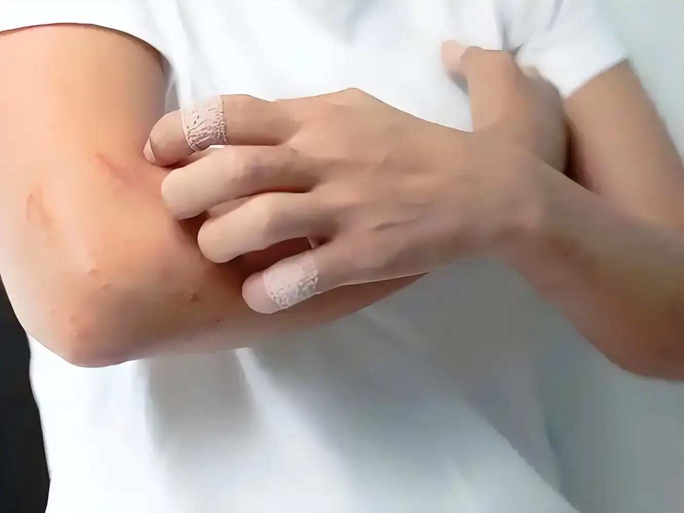 Dấu hiệu nguy hiểm nhất của bệnh tiểu đường không phải là khát nước, mà là sự xuất hiện thường xuyên của 10 bất thường này- Ảnh 5.