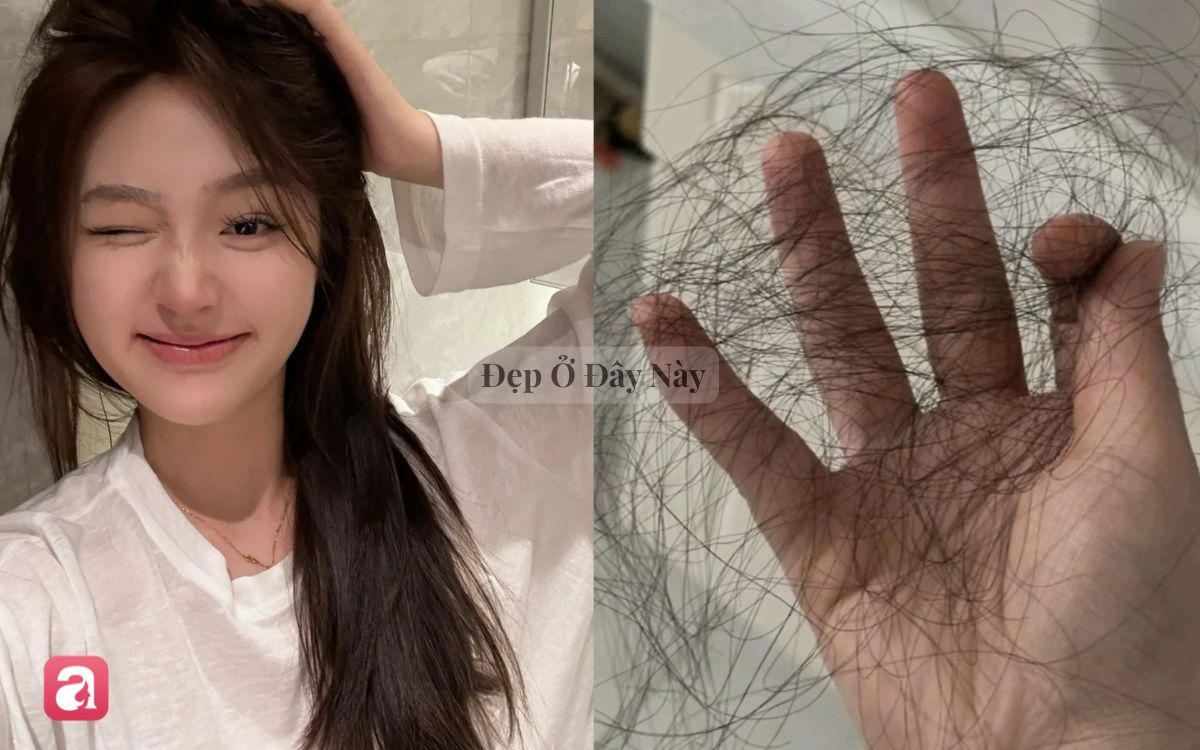 Cứ mỗi lần gội đầu l&agrave; t&oacute;c rụng cả nắm th&igrave; cứ &aacute;p dụng 5 c&aacute;ch n&agrave;y, hiệu quả đến 80% nếu l&agrave;m đ&uacute;ng v&agrave; đều đặn- Ảnh 1.