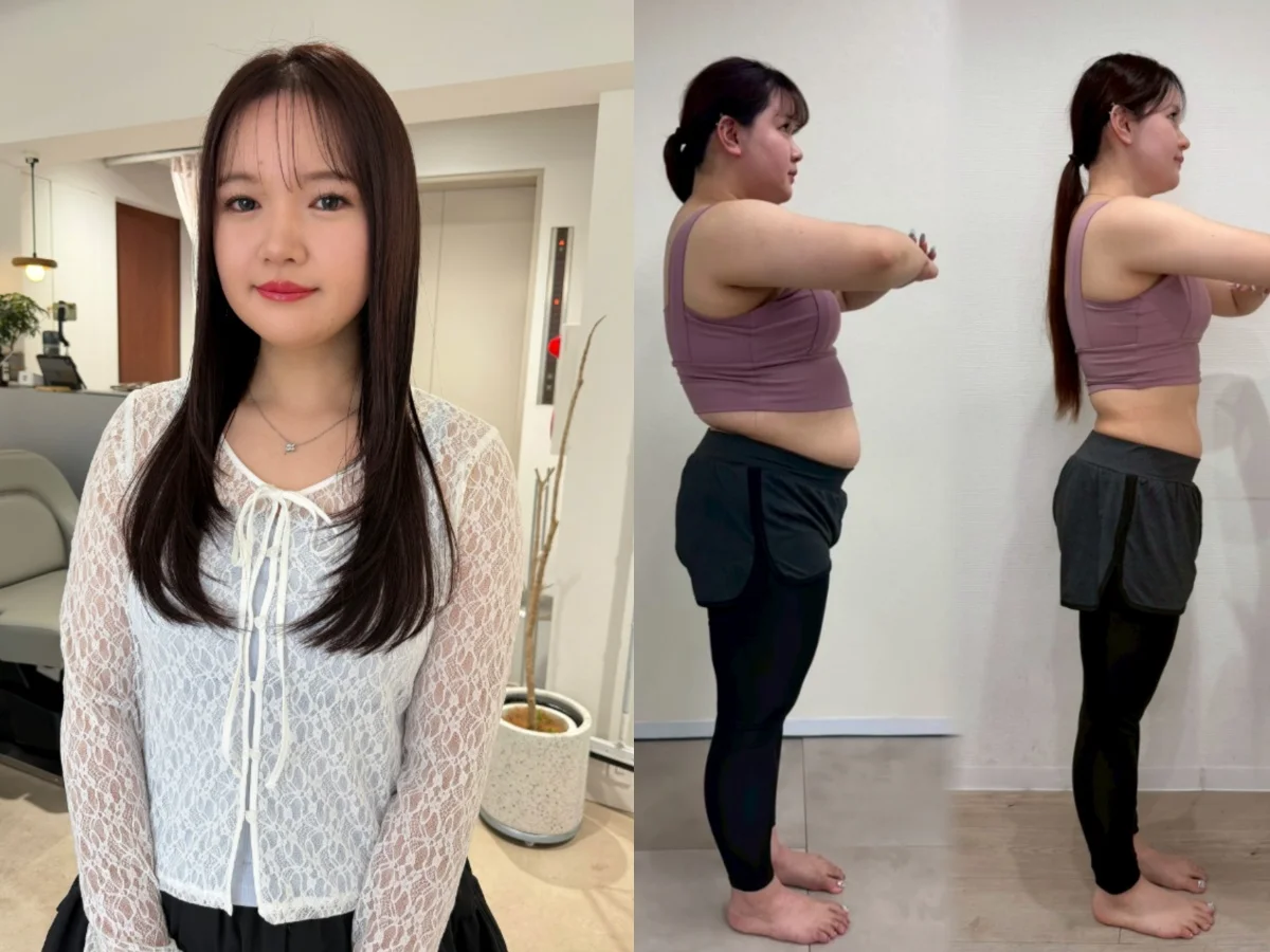 Một năm giảm 22kg, c&ocirc; g&aacute;i Nhật thay đổi ngoạn mục: &ldquo;T&ocirc;i kh&ocirc;ng muốn cả đời chỉ xinh đẹp nhờ chỉnh ảnh&rdquo;- Ảnh 2.