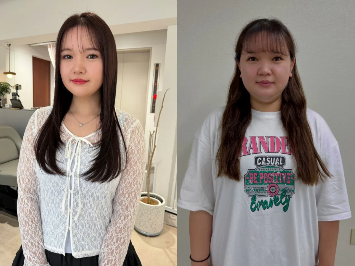 Một năm giảm 22kg, c&ocirc; g&aacute;i Nhật thay đổi ngoạn mục: &ldquo;T&ocirc;i kh&ocirc;ng muốn cả đời chỉ xinh đẹp nhờ chỉnh ảnh&rdquo;- Ảnh 1.