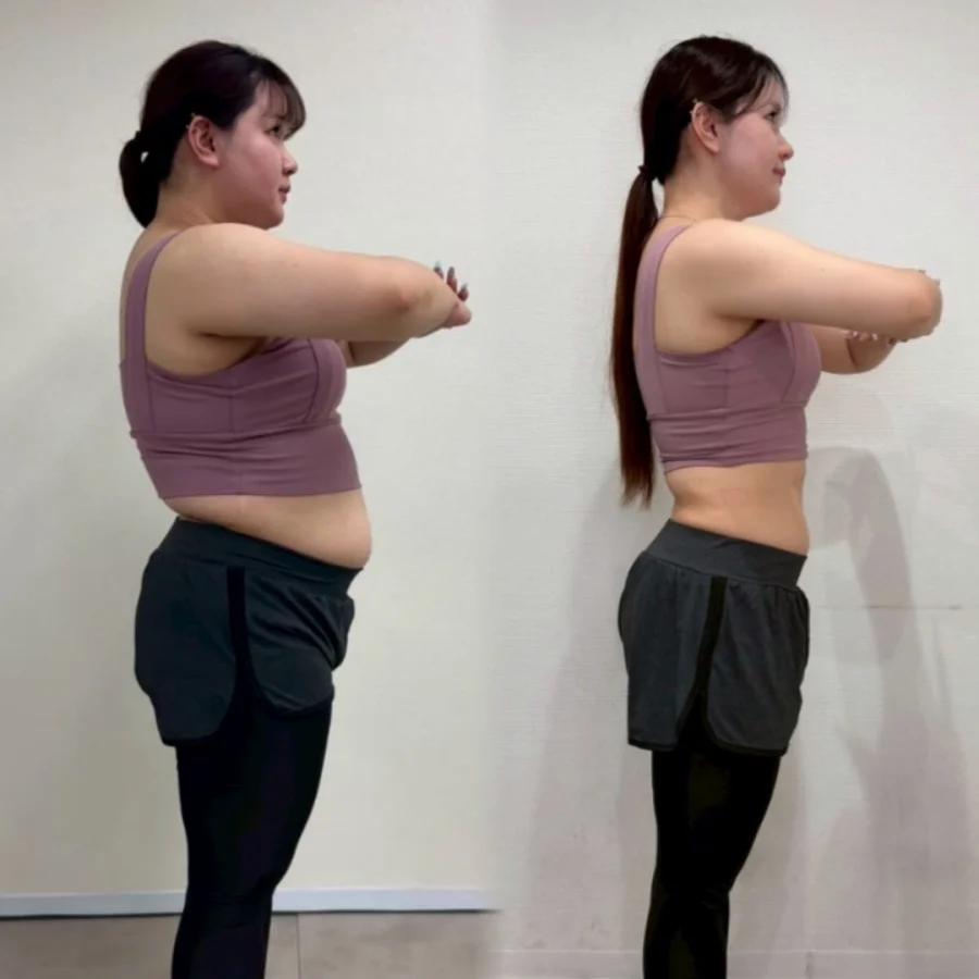 Một năm giảm 22kg, c&ocirc; g&aacute;i Nhật thay đổi ngoạn mục: &ldquo;T&ocirc;i kh&ocirc;ng muốn cả đời chỉ xinh đẹp nhờ chỉnh ảnh&rdquo;- Ảnh 4.