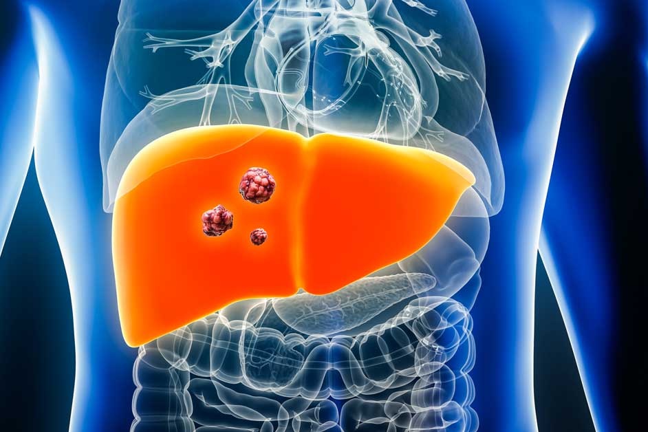 Nam ca sĩ 27 tuổi qua đời v&igrave; bệnh gan, b&aacute;c sĩ nhắc nhở: Thấy 7 điều phải kh&aacute;m trước khi qu&aacute; muộn! - Ảnh 4.