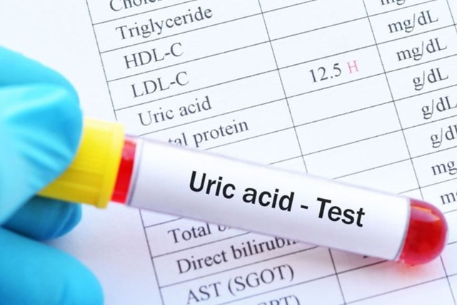 Người đ&agrave;n &ocirc;ng 30 tuổi tử vong sau cơn đau lưng dữ dội, b&aacute;c sĩ cảnh b&aacute;o m&oacute;n "vạn người m&ecirc;"- Ảnh 2.