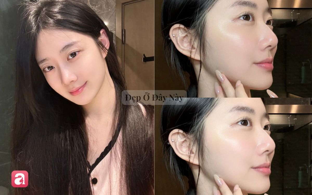 5 lọ toner acid được v&iacute; như "nước thần" cho l&agrave;n da l&atilde;o h&oacute;a, xỉn m&agrave;u - Ảnh 1.