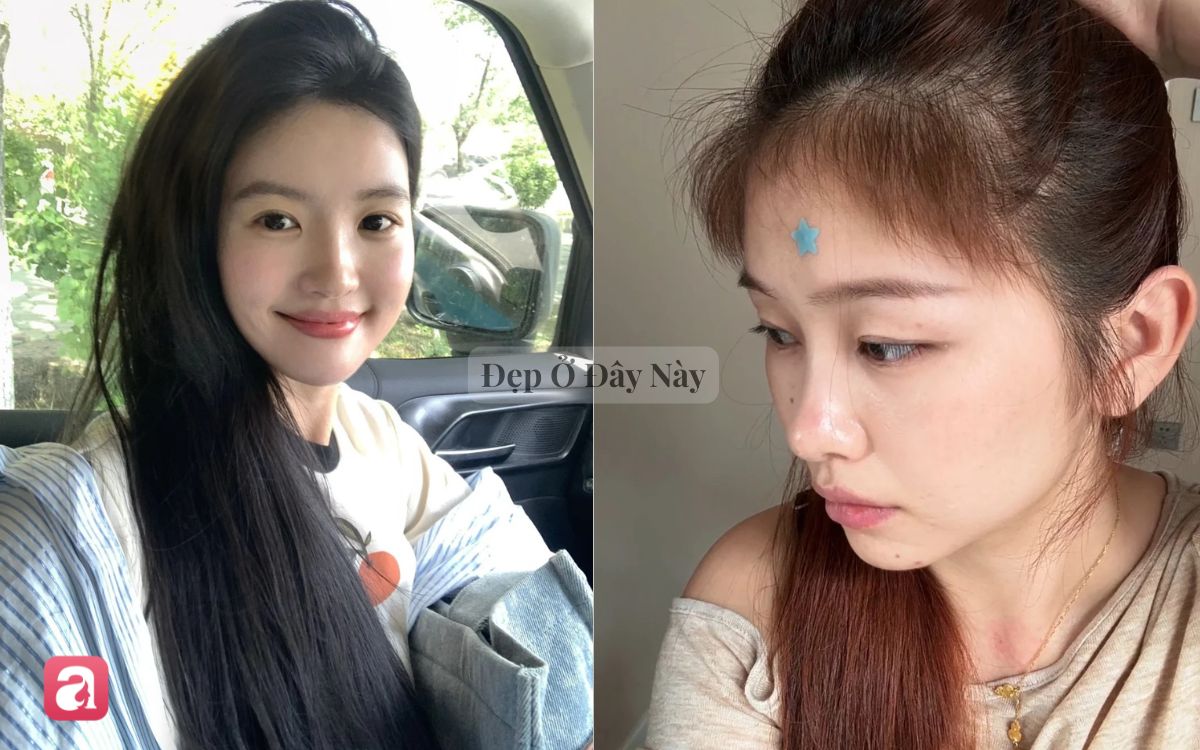 5 lọ serum t&oacute;c "made in Vietnam" l&agrave; thần dược cho n&agrave;ng t&oacute;c yếu, dễ g&atilde;y rụng - Ảnh 1.