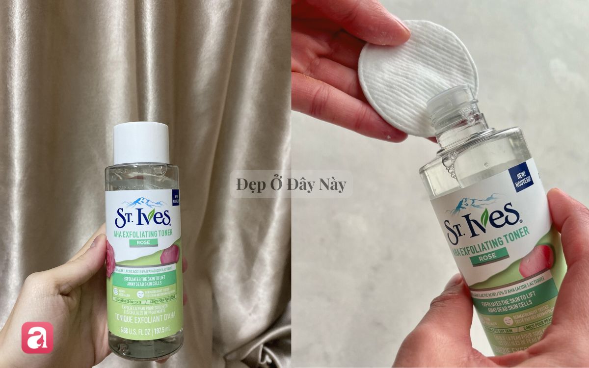 5 lọ toner acid được v&iacute; như "nước thần" cho l&agrave;n da l&atilde;o h&oacute;a, xỉn m&agrave;u - Ảnh 6.