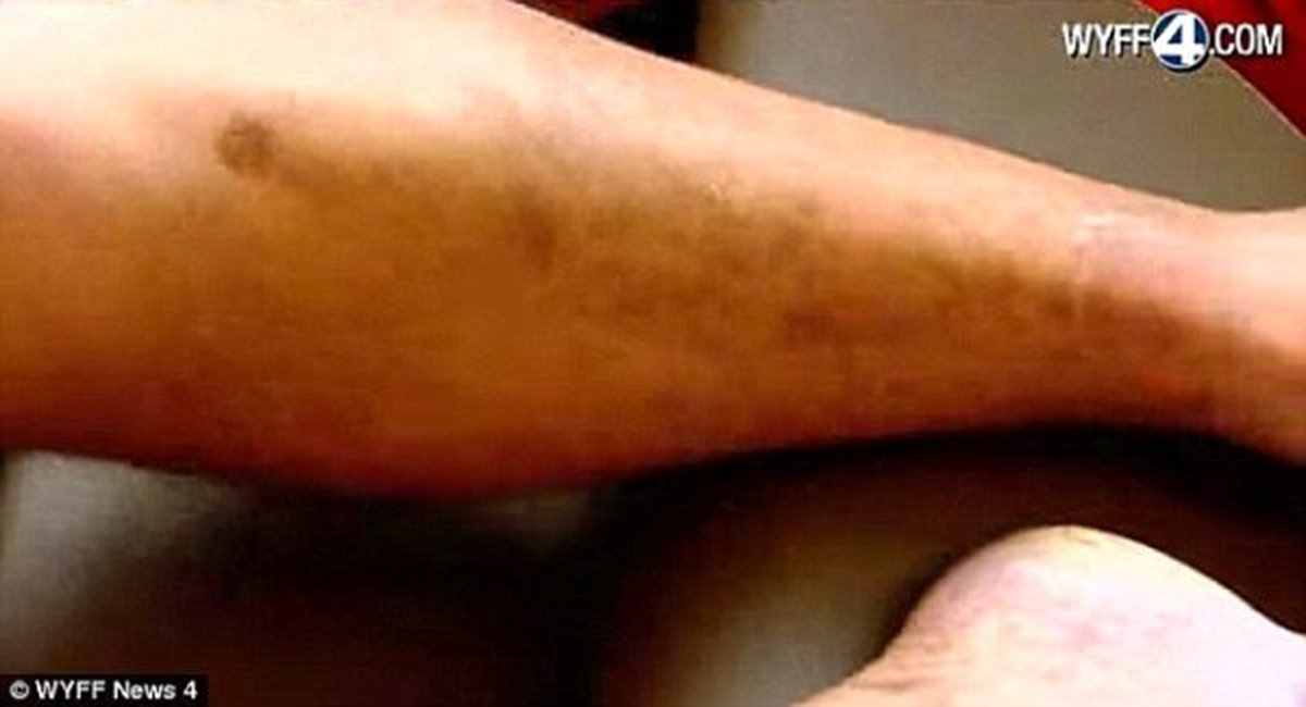 11 lần bị s&eacute;t đ&aacute;nh vẫn sống, người đ&agrave;n &ocirc;ng khiến cả thế giới kinh ngạc - Ảnh 2.