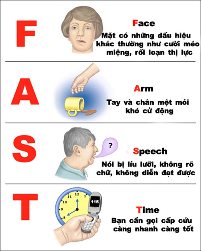 Vừa tỉnh sau cơn đột quỵ nặng, người đàn ông 45 tuổi ở Bệnh viện Bạch Mai lập tức viết một điều cho vợ- Ảnh 2.