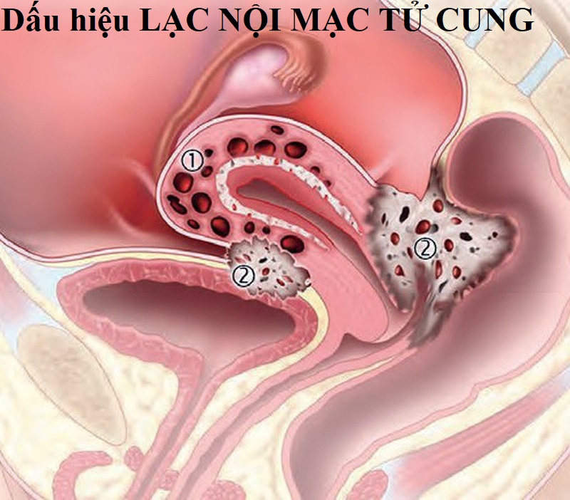 Giành được giải điện ảnh cho bộ phim về chính căn bệnh mình mắc phải nhưng 24 giờ sau, nữ đạo diễn phải nằm liệt giường - Ảnh 3.