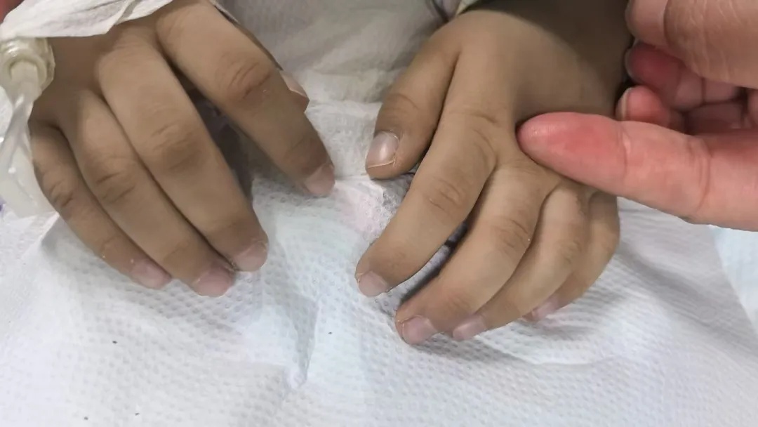 B&eacute; 3 tuổi t&iacute;m t&aacute;i, b&aacute;c sĩ ph&aacute;t hiện ngộ độc nitrit: 6 kiểu đồ ăn thừa cha mẹ n&ecirc;n lưu &yacute; - Ảnh 2.