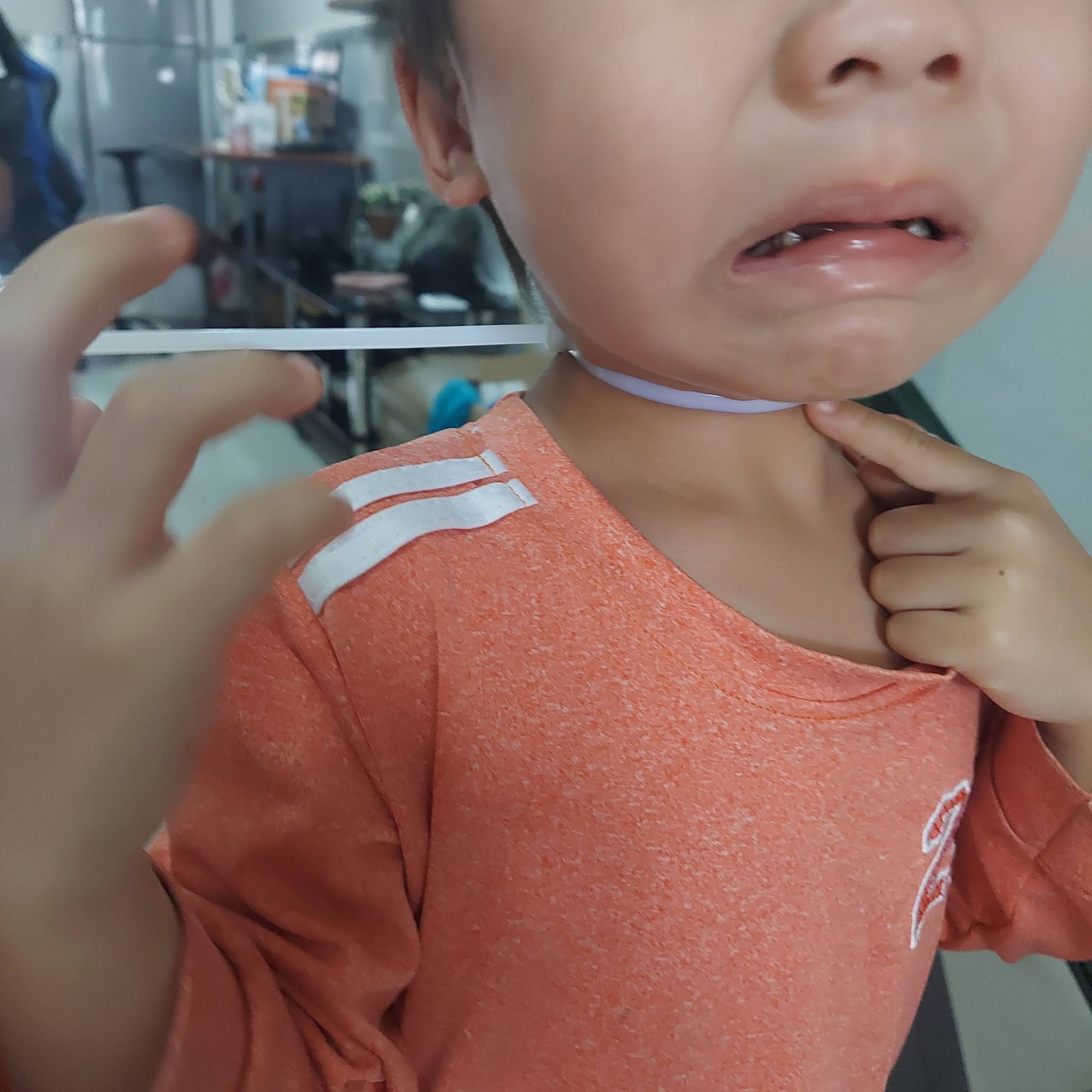 Mẹ trẻ chia sẻ phen "đứng tim" khi thấy con trai bị d&acirc;y r&uacute;t nhựa siết chặt cổ- Ảnh 2.