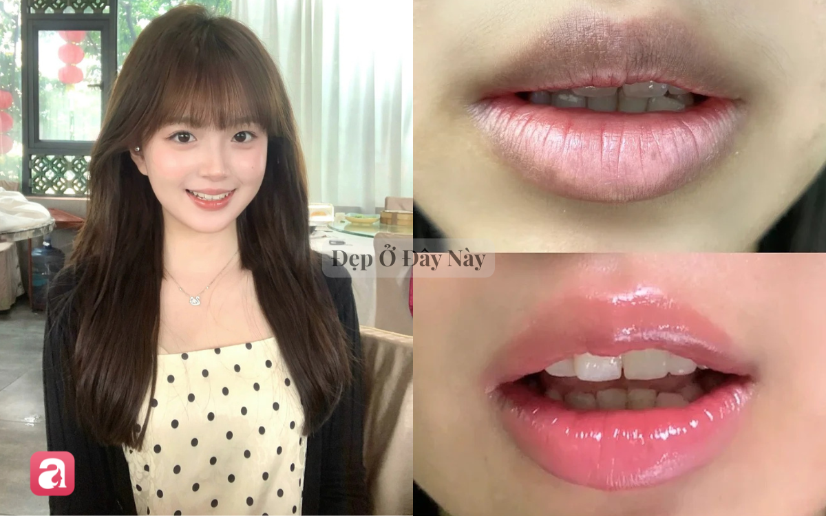 5 lọ dầu dưỡng môi lên màu đẹp tự nhiên, cho môi căng mọng và khóe miệng trẻ hẳn ra - Ảnh 1.