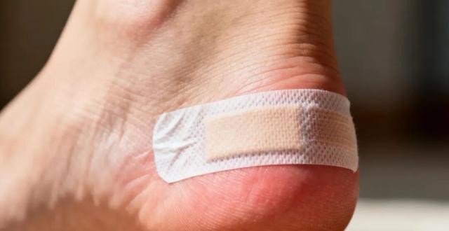 B&eacute; g&aacute;i sốt 39,3 độ C suốt 2 ng&agrave;y, nhập viện mới ph&aacute;t hiện thủ phạm l&agrave; 1 miếng băng c&aacute; nh&acirc;n- Ảnh 3.