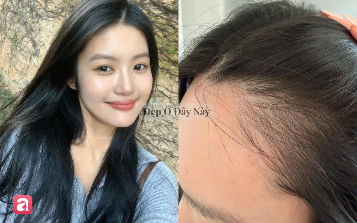 5 lọ dưỡng tóc bưởi "made in Vietnam" kích thích tóc mọc nhanh, giảm gãy rụng thấy rõ - Ảnh 6.