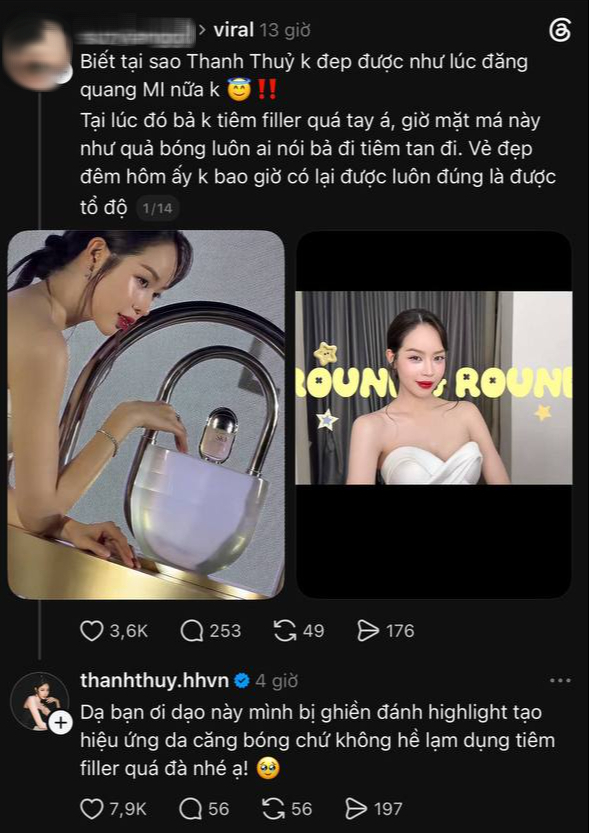 Bị n&oacute;i lạm dụng thẩm mỹ, kh&ocirc;ng c&ograve;n đẹp tự nhi&ecirc;n, Thanh Thuỷ l&ecirc;n tiếng- Ảnh 3.