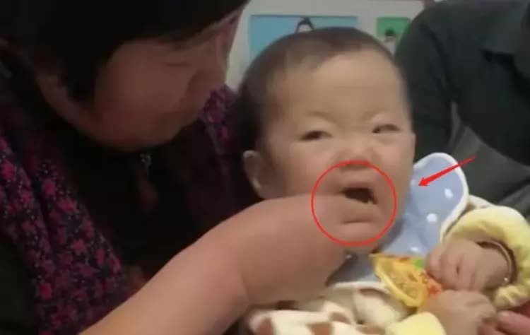 Trẻ kh&ocirc;ng ăn kẹo nhưng vẫn bị s&acirc;u răng th&igrave; mẹ n&ecirc;n cẩn thận với 4 th&oacute;i quen  - Ảnh 2.
