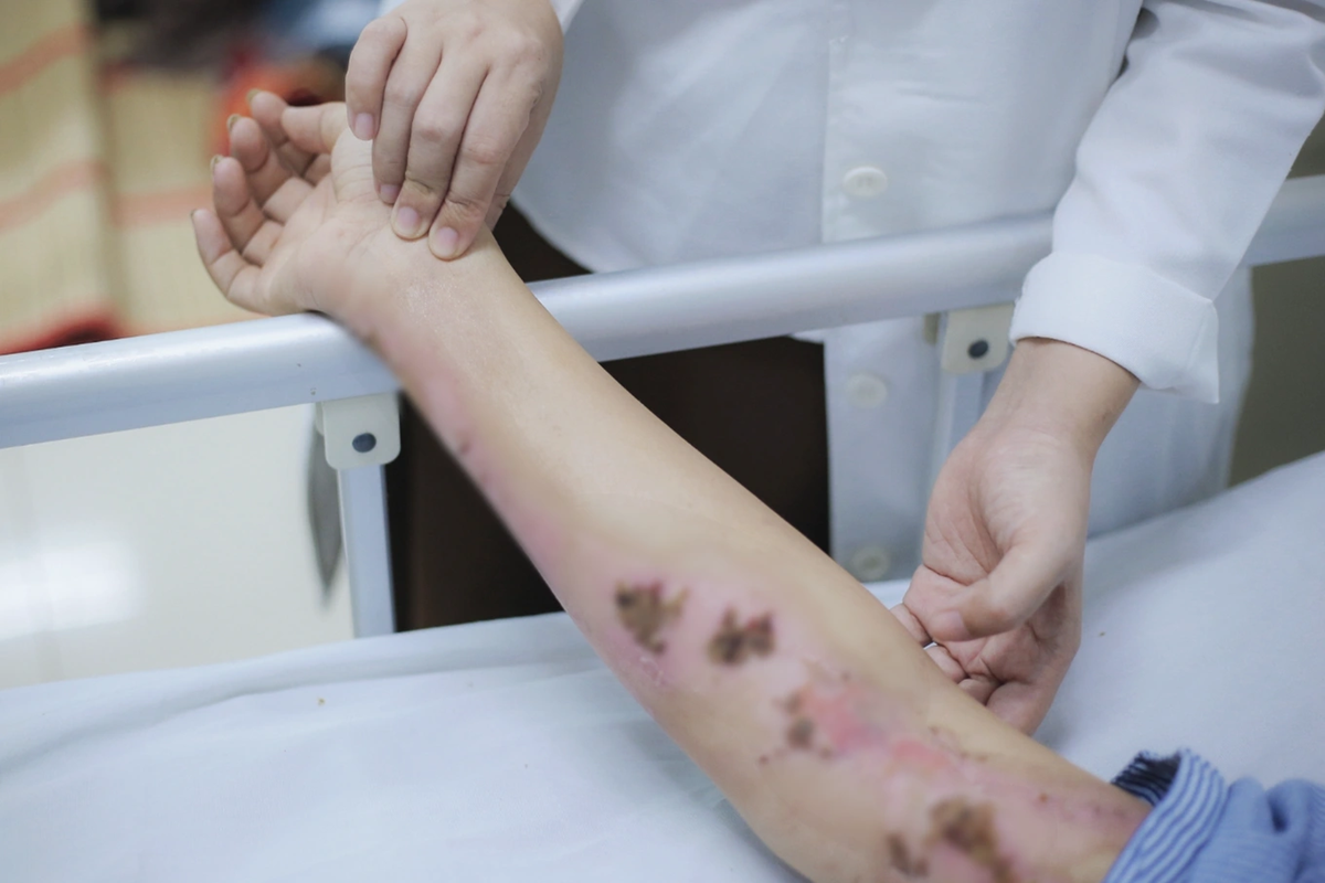 Đang đi ngo&agrave;i đường, c&ocirc; g&aacute;i 33 tuổi bị s&eacute;t đ&aacute;nh ch&aacute;y s&eacute;m cổ - Ảnh 1.