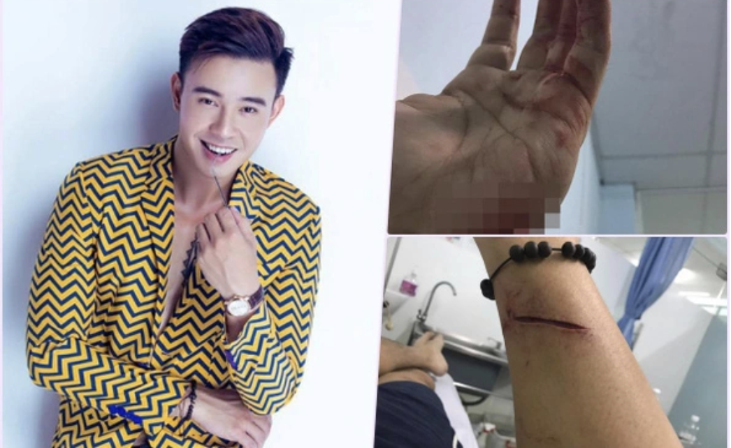 Ca sĩ Việt h&aacute;t ca kh&uacute;c 10 tỷ view vang danh Đại lễ: G&aacute;nh nợ 28 tỷ ở tuổi 20, đoạn t&acirc;m thư thấy r&otilde; sự thật   - Ảnh 4.