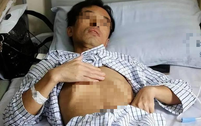 5 loại rau củ l&agrave; "vua thối gan", tiếp tay cho ung thư gan nhưng nhiều gia đ&igrave;nh Việt ăn v&ocirc; tư - Ảnh 4.