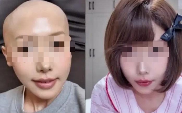 3 thói quen buổi tối tưởng "vô thưởng vô phạt" nhưng ai làm là tự cộng 50% nguy cơ ung thư vào người! - Ảnh 4.