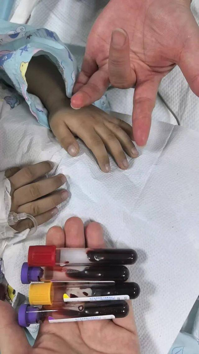 B&eacute; trai 3 tuổi nhập viện v&igrave; ngộ độc sau thời gian d&agrave;i ăn cơm, thức ăn để qua đ&ecirc;m- Ảnh 1.