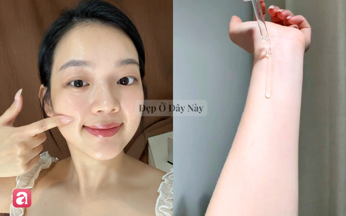 5 serum "made in Vietnam" kiềm dầu, giảm thâm rất hợp với làn da mụn - Ảnh 1.