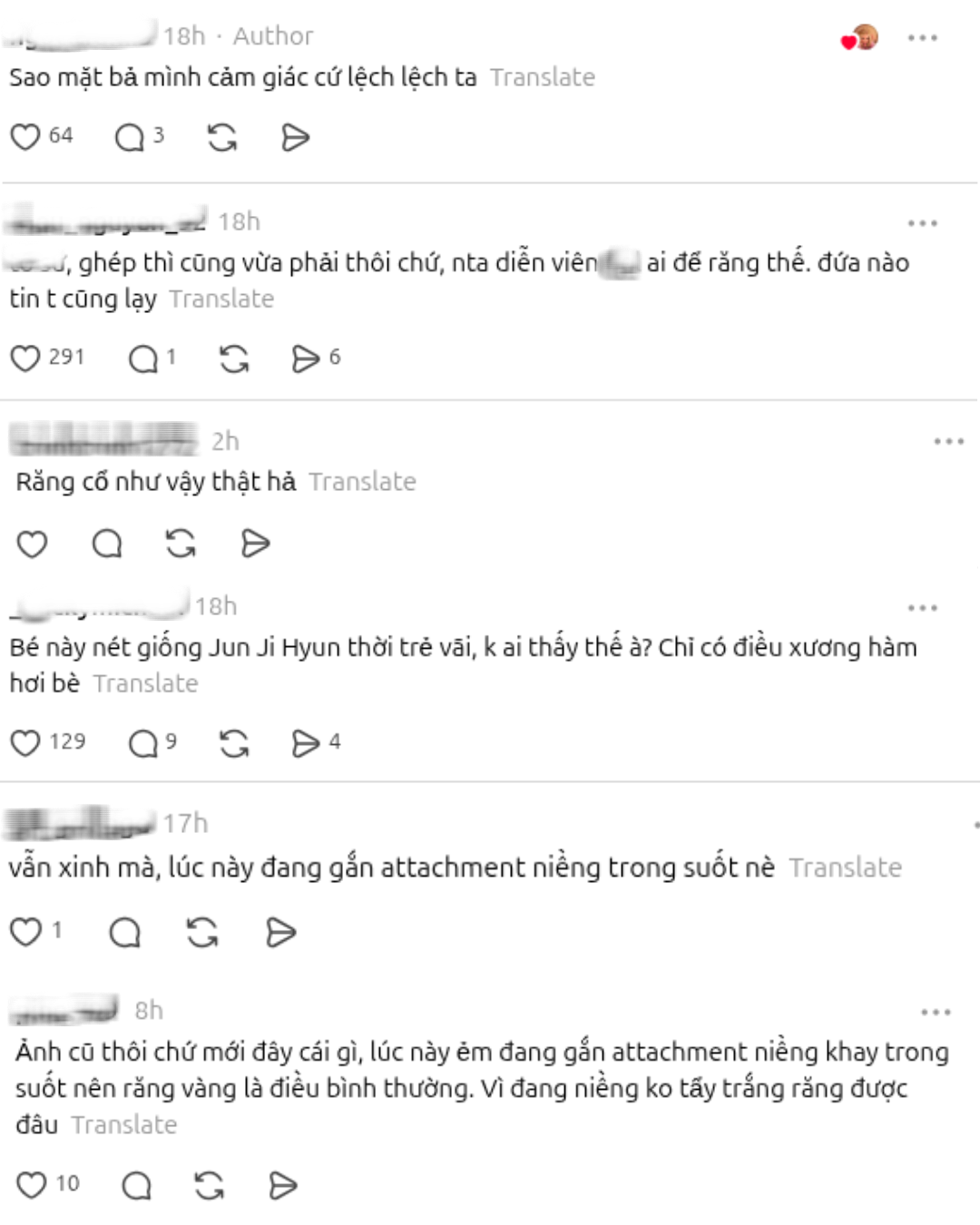 Nữ chính hot nhất Trung Quốc bị soi ảnh chưa chỉnh sửa, lộ răng vàng?- Ảnh 4.
