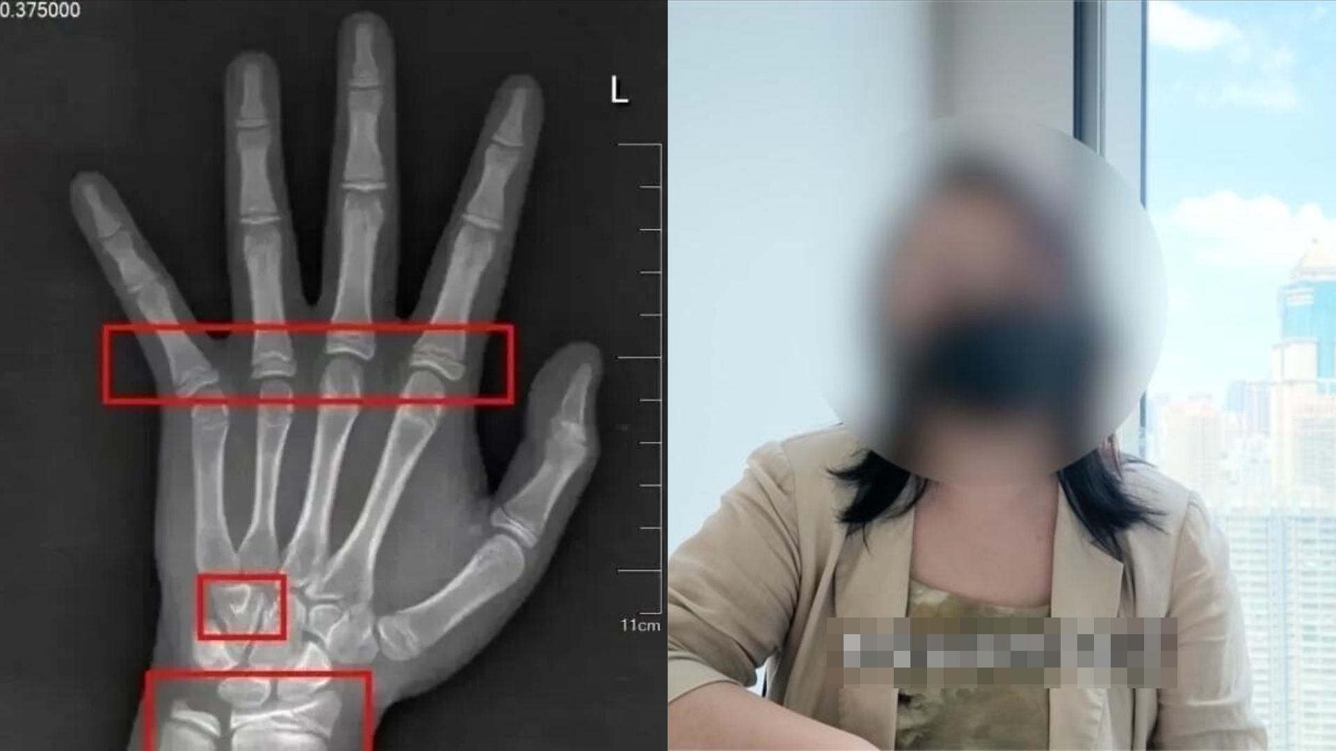 Bé gái đã có tuổi xương "chạy trước" gần 3 năm, đây là 4 sai lầm mà cha mẹ Việt thường mắc phải- Ảnh 1.