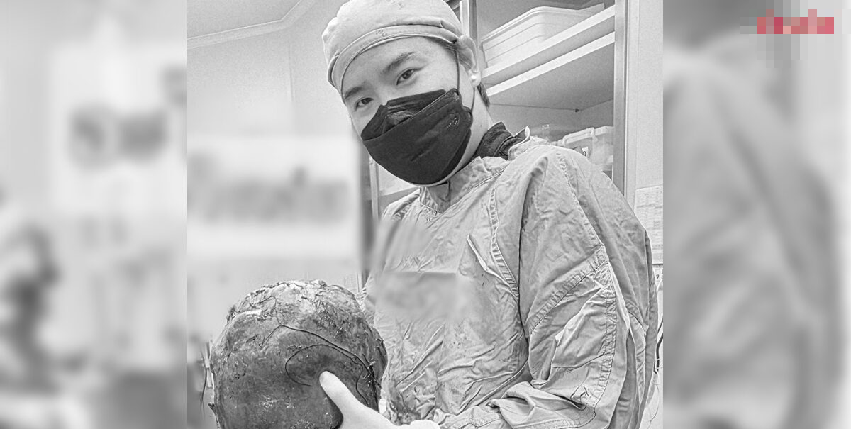 Bác sĩ sững người trước "thứ đáng sợ" trong bụng bệnh nhân - Ảnh 1.
