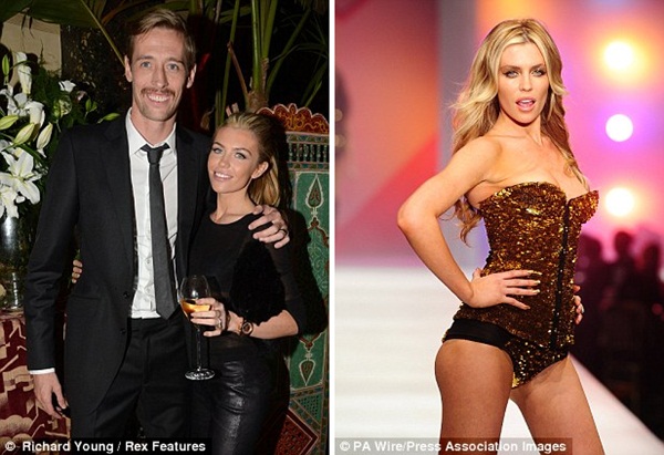 Peter Crouch bị đánh cùi chỏ gẫy răng 4