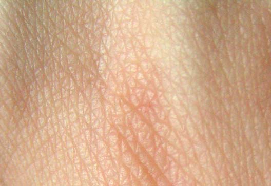 HumanSkinCloseup.jpg