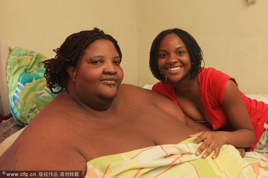 Bà mẹ 310kg qua đời vì muốn giảm béo 3