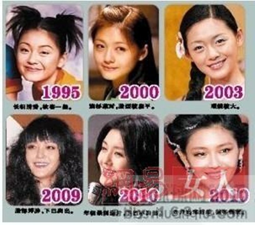 Những sao nữ bị gh&eacute;t v&igrave; &ldquo;c&atilde;i phăng&rdquo; chuyện thẩm mỹ 17