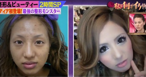 Chùm ảnh nhan sắc người mẫu Nhật trước và sau phẫu thuật thẩm mỹ 4
