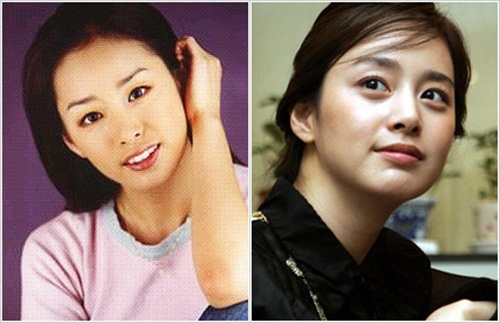 Rộ nghi vấn Kim Tae Hee sửa mắt, nâng ngực 3