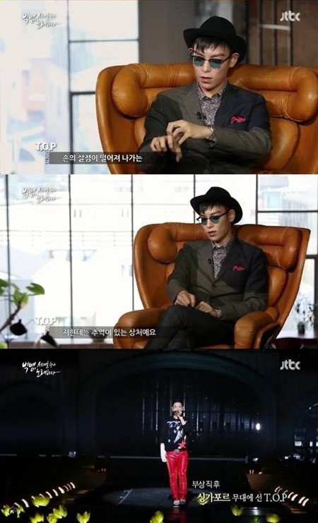 Seungri bất lực nh&igrave;n T.O.P (Big Bang) biểu diễn với tay băng b&oacute; 1