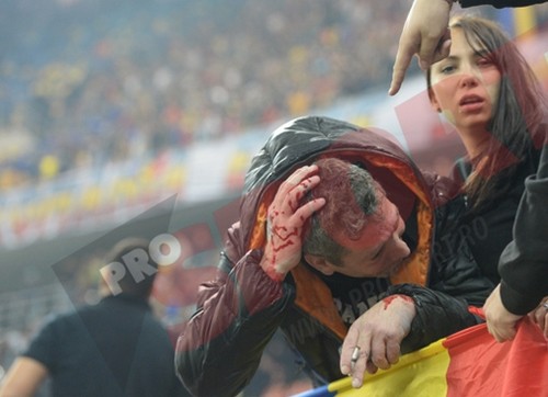 Bạo lực kinh hoàng trong trận đấu vòng loại EURO 2016 4