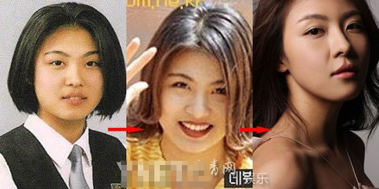 Ha Ji Won bị nghi mới tiêm botox 7